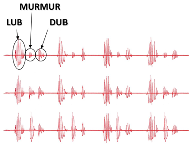 Murmur waveform