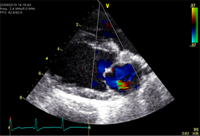 Echocardiogram image